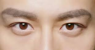 Common Cosmetic Eye Surgeries People Seek for Defined and Attractive Features
